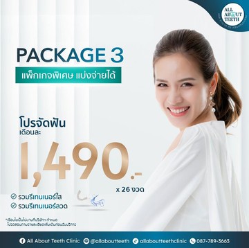 จัดฟันธรรมดาและรอบสอง2