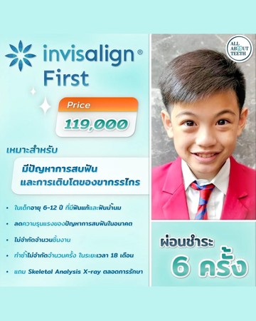 จัดฟันใส11268608987152