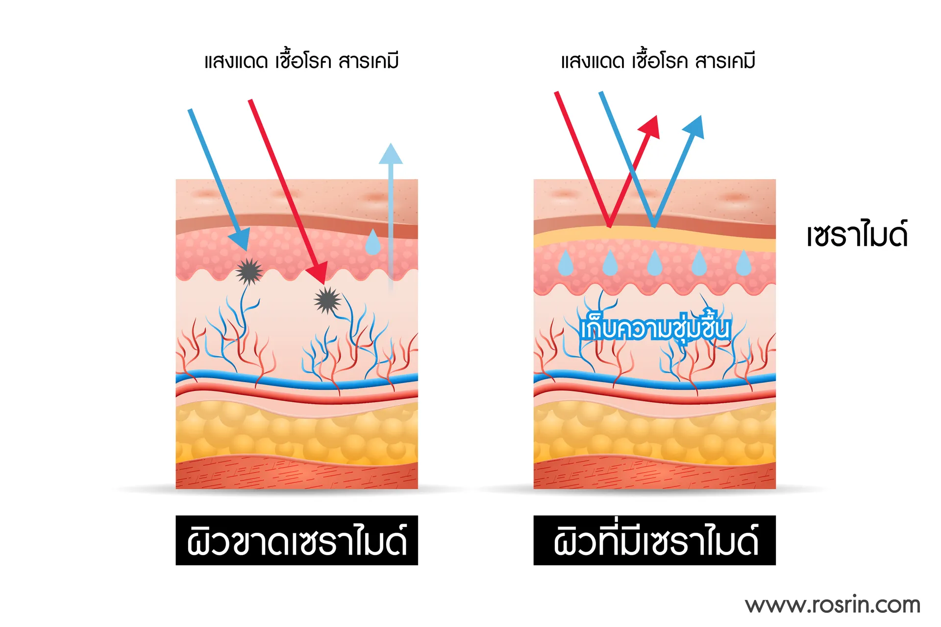 RosrinCeramide-03