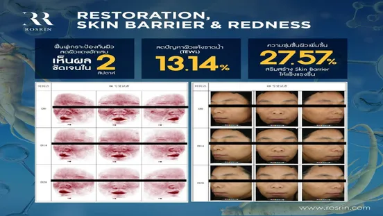 Slide38