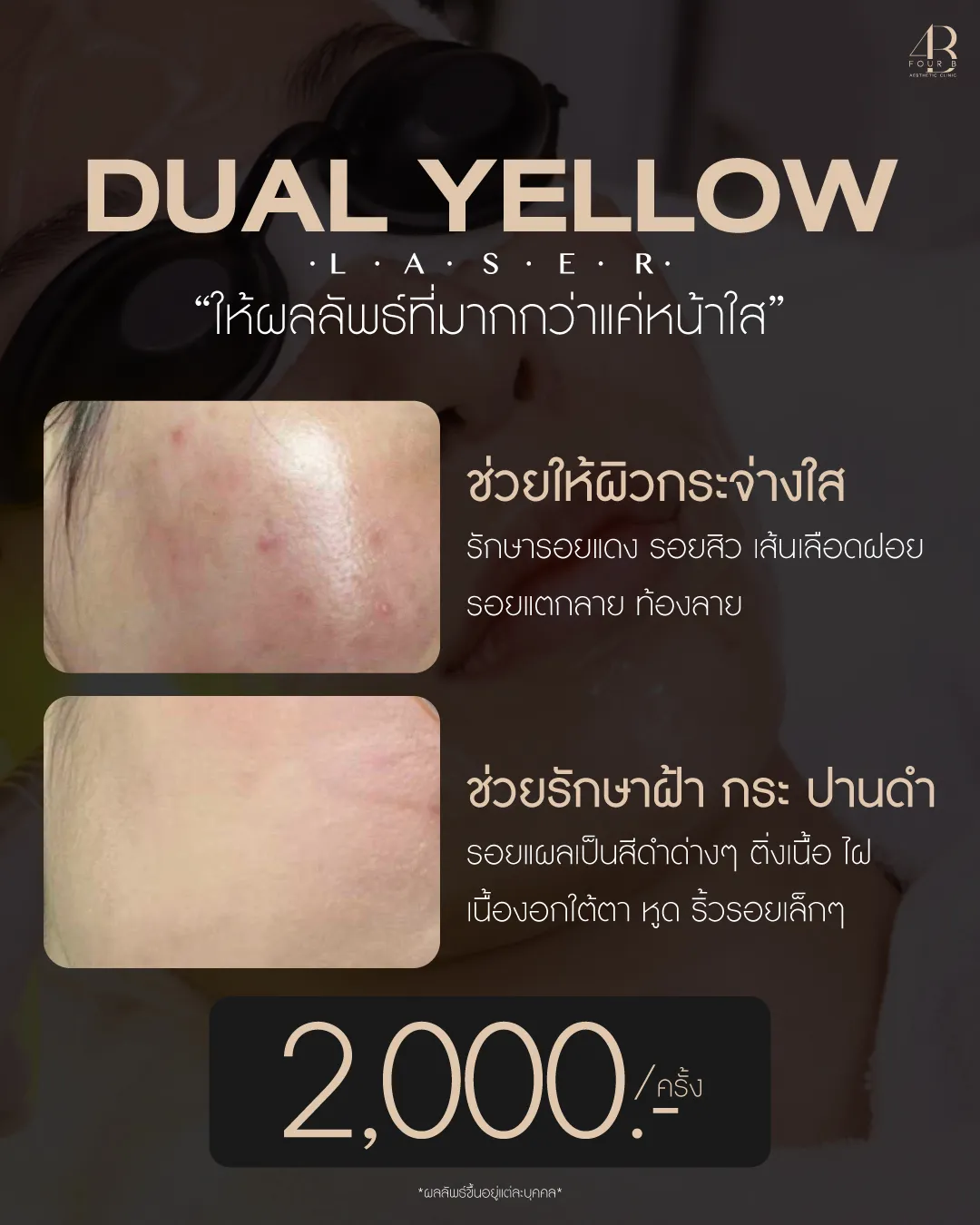 DualYellow