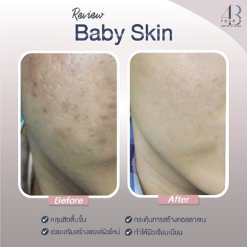 Babyskin(3)