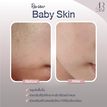 Babyskin(4)