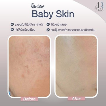 Babyskin(5)