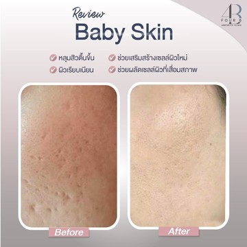 Babyskin(6)