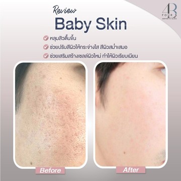 Babyskin(7)