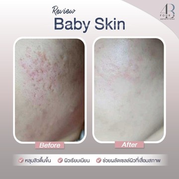 Babyskin(8)