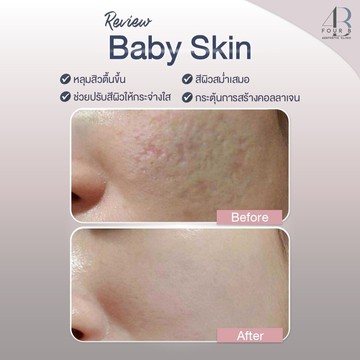 Babyskin(9)