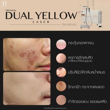 Dualyellow(1)