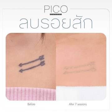 PICO(11)