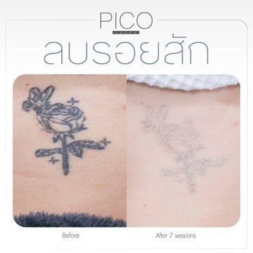 PICO(4)