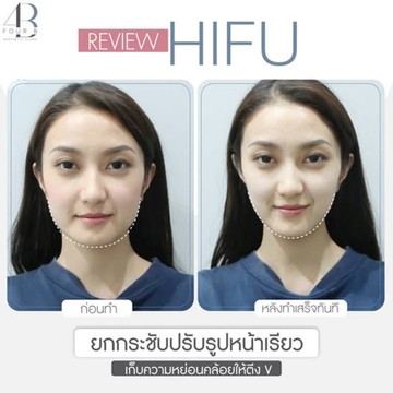 img-review03