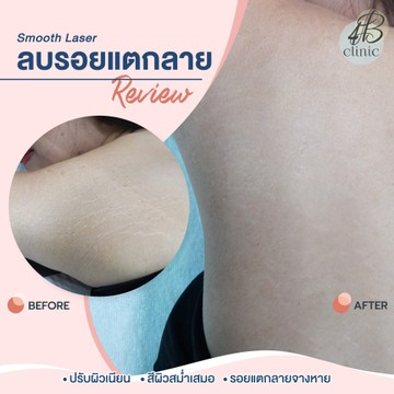 แตกลาย(15)