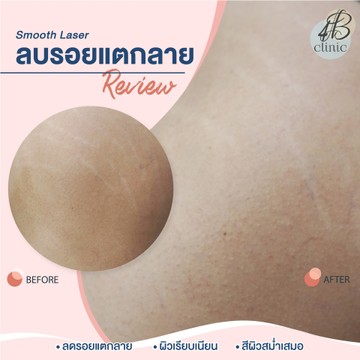 แตกลาย(16)