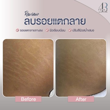 แตกลาย(19)