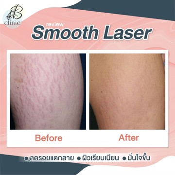 แตกลาย(4)