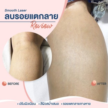 แตกลาย(4)