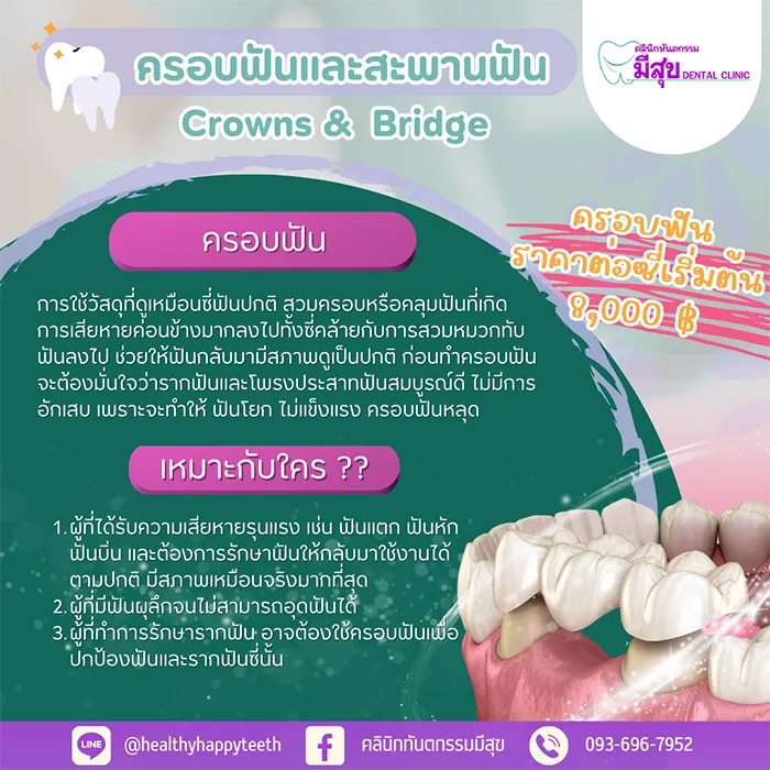 ครอบฟันเหมาะกับใคร
