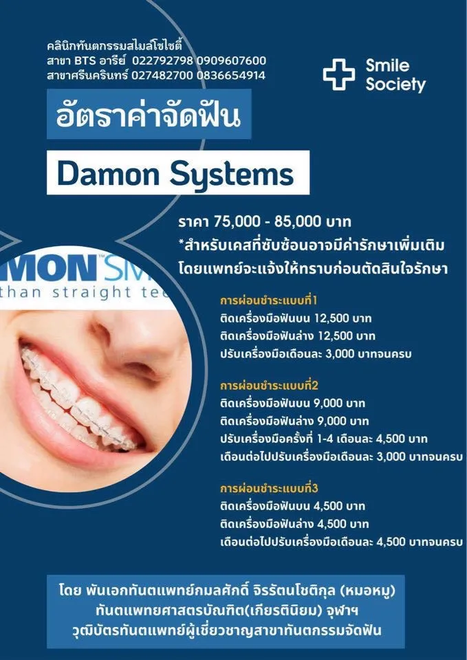 ราคาอารีย์(1)