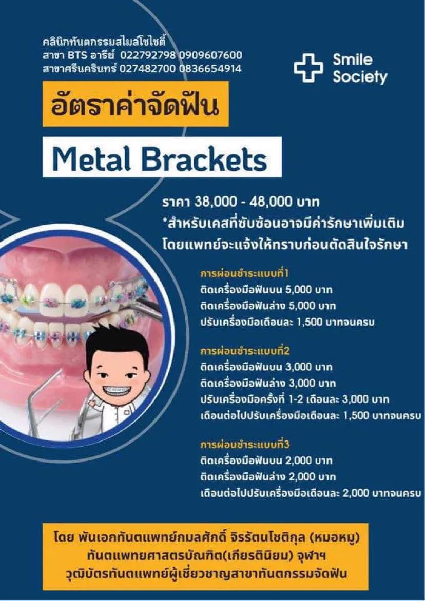 ราคาอารีย์3