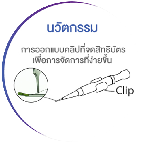 ทำไมถึงต้องเลือก1