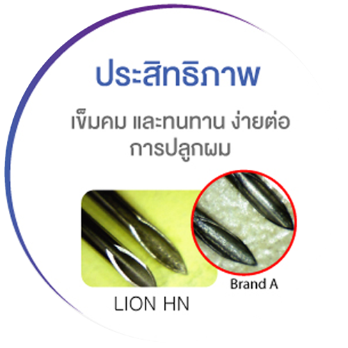 ทำไมถึงต้องเลือก3