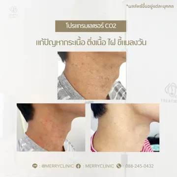 merryclinicthailand(1)