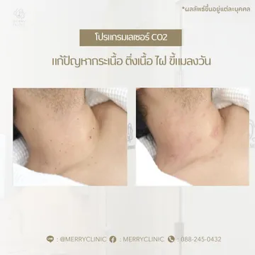 merryclinicthailand(2)