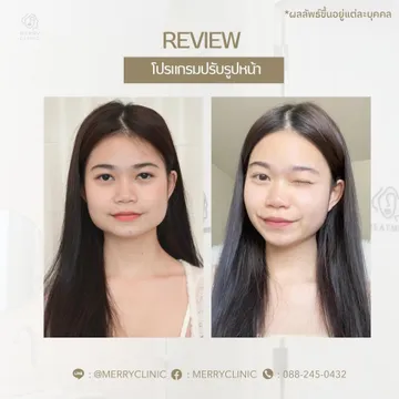 merryclinicthailand(2)