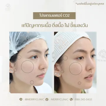 merryclinicthailand(3)