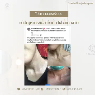 merryclinicthailand(4)