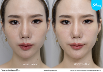 patrawutclinic-ขั้นตอนปรึกษา