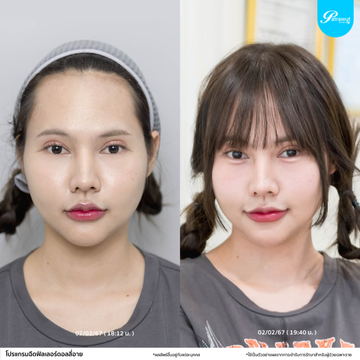 patrawutclinic-ดอลลี่อาย2