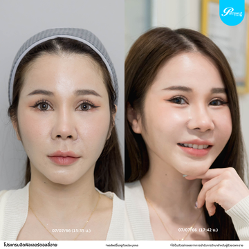 patrawutclinic-ดอลลี่อาย3