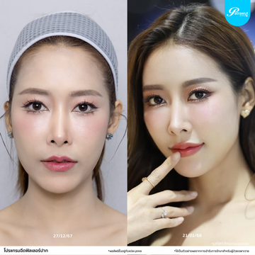 patrawutclinic-ตามทรงปากเดิม