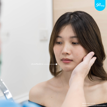 patrawutclinic-ร้อยไหมคืออะไร