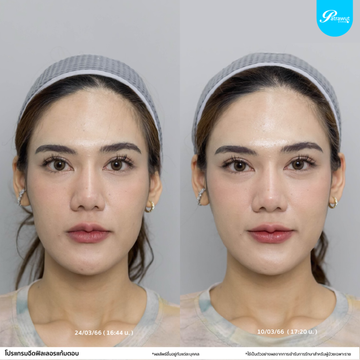 patrawutclinic-แก้มตอบ02