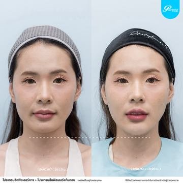 patrawutclinic-แก้มตอบ03