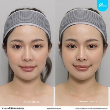 patrawutclinic-แก้มตอบ04