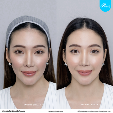 patrawutclinic-แก้มตอบ