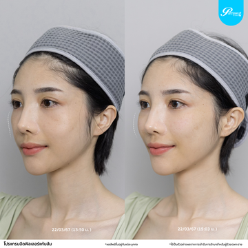 patrawutclinic-แก้มส้ม02