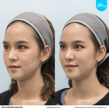 patrawutclinic-แก้มส้ม