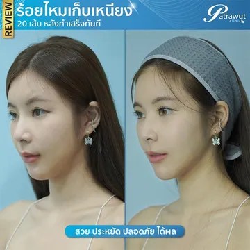 ร้อยไหมเหนียงคุณซัน1347044179931