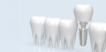 dentis-th(3)