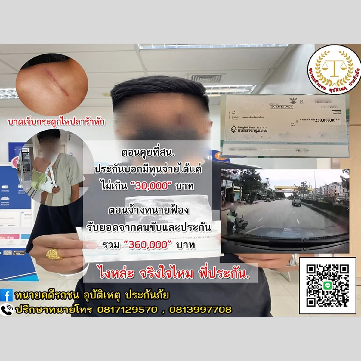 9-ไหปลาร้าหัก-รับเงินรวมเกือบ-400,000-บาท