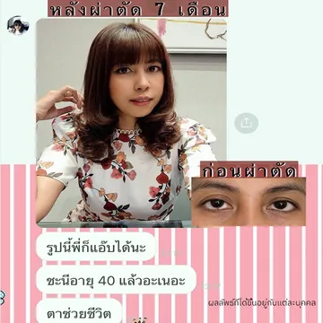 majesticeyeclinic(10)