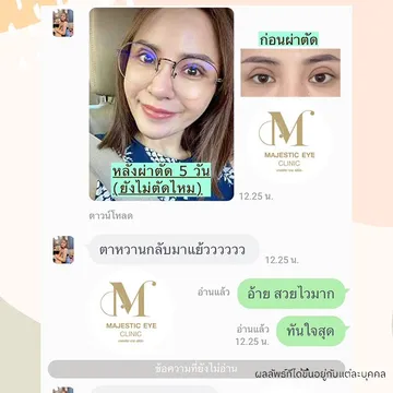 majesticeyeclinic(12)