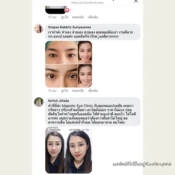 majesticeyeclinic(22)