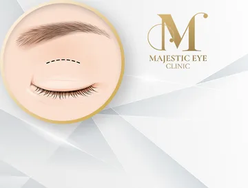 majesticeyeclinic-service1