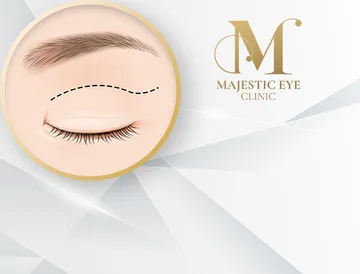 majesticeyeclinic-service2